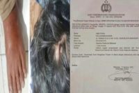Luka fisik yang terlihat jelas di tubuh bagian kaki dan kepala Andi Faisal (44) (kiri) dan surat keterangan /Laporan polisi. Foto Dok:(Ist)