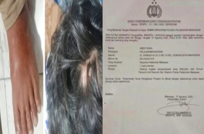 Luka fisik yang terlihat jelas di tubuh bagian kaki dan kepala Andi Faisal (44) (kiri) dan surat keterangan /Laporan polisi. Foto Dok:(Ist)