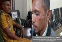 Kepala Desa (Kades) Letmafo, Kecamatan Insana Tengah, Kabupaten Timor Tengah Utara (TTU), Donatus Nesi, terduga pelaku pengeroyokan (kiri) dan wartawan media online ViralNTT.COM, koraban pengenroyokan (FP), Selasa (2/9/2025) sore. Foto Dok: Handover