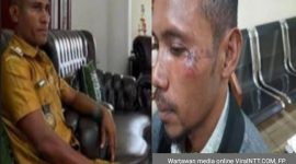 Kepala Desa (Kades) Letmafo, Kecamatan Insana Tengah, Kabupaten Timor Tengah Utara (TTU), Donatus Nesi, terduga pelaku pengeroyokan (kiri) dan wartawan media online ViralNTT.COM, koraban pengenroyokan (FP), Selasa (2/9/2025) sore. Foto Dok: Handover