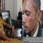Kepala Desa (Kades) Letmafo, Kecamatan Insana Tengah, Kabupaten Timor Tengah Utara (TTU), Donatus Nesi, terduga pelaku pengeroyokan (kiri) dan wartawan media online ViralNTT.COM, koraban pengenroyokan (FP), Selasa (2/9/2025) sore. Foto Dok: Handover